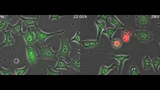 Zika virus infected cells [upl. by Dysart]