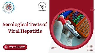 Serological Tests of Viral Hepatitis [upl. by Gav]