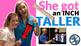 21 yearold woman grows TALLER with chiropractic approach [upl. by Phyl]