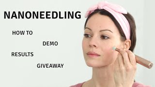 Nano Needling  Everything You Need to Know  Giveaway [upl. by Goodrich]