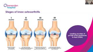 Benenden Hospital webinar Treatment for knee osteoarthritis [upl. by Aldercy]