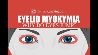 Eyelid Myokymia  Why do my eyes keep jumping [upl. by Anitaf]