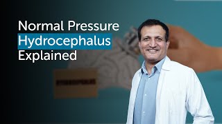 Understanding Normal Pressure Hydrocephalus Symptoms Diagnosis amp Treatment  Gleneagles Hospital [upl. by Riedel]