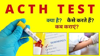 ACTH Test in Hindi  ACTH Test Procedure Preparation  Explained in Hindi [upl. by Ellicott]