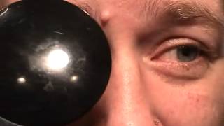 Corneal Reflex Assessment  CN V  OSCE Clip  UKMLA  CPSA [upl. by Ellerrehs]