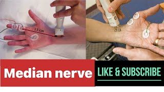 MEDIAN NERVE NERVE CONDUCTION STUDY  NCS  NCV emg ncs ncv neuroscience [upl. by Lennon20]