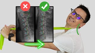 Best Exercise to Fix Loss of Neck Curve cervical lordosis or Military Neck  Dr Jon Saunders [upl. by Marih]