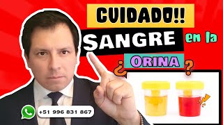 CUIDADO ⚠️ ¿SANGRE EN LA ORINA¿POR QUÉ [upl. by Cordalia825]