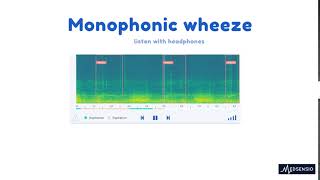 Lung sounds  monophonic wheeze [upl. by Oahc]