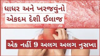 ધાધર ખરજવું નો દેશી ઈલાજ । dhadhar no ilaj gujarati । skin disease home remedy [upl. by Strephon]