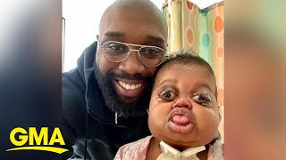 Dad pens letters to his baby with Pfeiffer syndrome vows to be father he never had l GMA [upl. by Harness179]