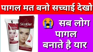 skinkler cream  skinkler cream side effects in hindiskinkler cream review in hindi [upl. by Rumery337]