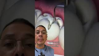 How Does a Dentist Fill a Cavity  View Mobile Dental [upl. by Rodman115]