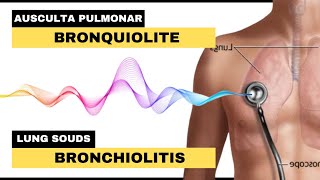 BRONQUIOLITE AUSCULTA PULMONAR  Bronchiolitis Lung Sounds [upl. by Suissac]