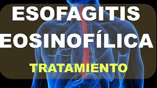 Tratamiento de la Esofagitis Eosinofílica [upl. by Eudo]