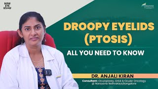 Droopy Eyelids Ptosis Explained  Dr Anjali Kiran  English [upl. by Marilou]