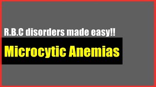 Microcytic Anemias made easy  RBC Disorders  Hematology Usmle Step 1 [upl. by Rodmann]