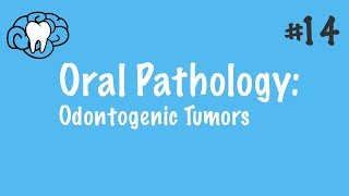 Oral Pathology  Odontogenic Tumors  INBDE ADAT [upl. by Otha]