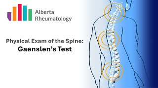 Rheumatology BACK exam Gaenslens Test [upl. by Airot745]