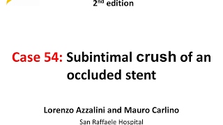 Case 54 Manual of CTO Interventions  Subintimal stent crushing [upl. by Cia]