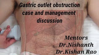 Gastric outlet obstruction due to carcinoma stomach case discussioncontinued [upl. by Ellicec]