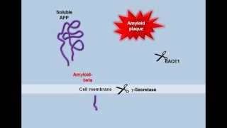 Plaque Formation in the Alzheimers Brain [upl. by Aicilana650]