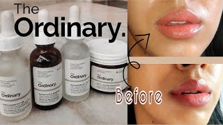 The Ordinary Skincare for Hyperpigmentation  Uneven Skintone Best Products to fade pigmentation [upl. by Varden]