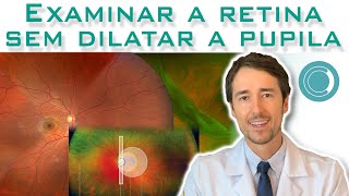 Para examinar a retina é obrigatório dilatar a pupila [upl. by Calvin595]