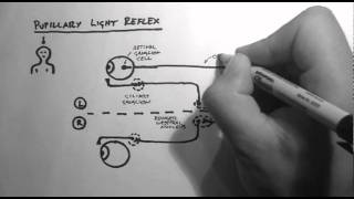 Reflexes 2  Pupillary Light Reflex [upl. by Pooley]