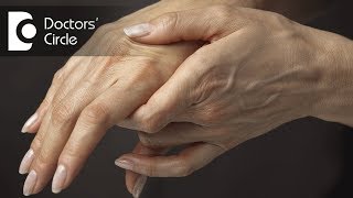 Role of homeopathy in treating Rheumatoid Arthritis  Dr Surekha Tiwari [upl. by Orsola538]