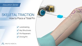 How to Place a Tibial Pin  Skeletal Traction Animation [upl. by Girish373]