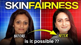 Fairness cream  Do they work  How to lighten skin tone  Dermatologist [upl. by Airuam]