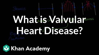 What is valvular heart disease  Circulatory System and Disease  NCLEXRN  Khan Academy [upl. by Greggory]