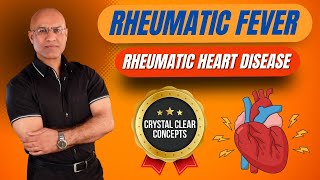 Rheumatic Fever Pathophysiology  Rheumatic Heart Disease [upl. by Yentterb]