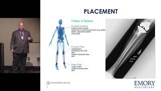 Intraosseous Access  David Carpenter MPAS PAC [upl. by Ferri]