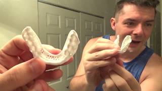 Sisu Mouthguard Molding and Review [upl. by Wanda]