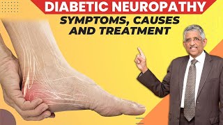 What Causes Diabetic Neuropathy  Peripheral Neuropathy  Dr V Mohan [upl. by Eissirc]