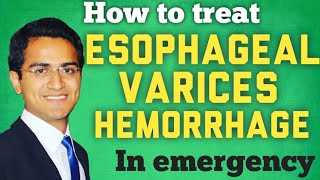 Esophageal Varices amp Variceal Hemorrhage Treatment and ManagmentSTEP WISE APPROACH [upl. by Ecnarwal]