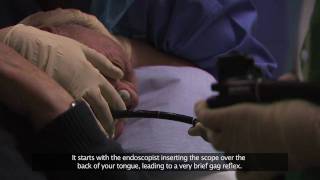 Bournemouth Digestive Diseases Centre Gastroscopy Procedure Subtitled [upl. by Aeslahc]