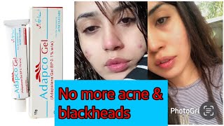 How to use Tretinoin  Skincare products Layer step by step skincare tretinoin [upl. by Chas965]