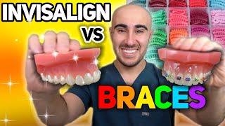 Braces vs Invisalign Cost Tooth Pain Speed etc  The ULTIMATE Review 🔥 [upl. by Lammaj]