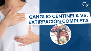 Ganglio Centinela vs Extirpación Completa [upl. by Rodney]