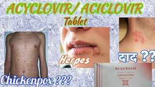 Acyclovir tablets  Herpikind  Herpikind Tablet  Zovirax  Zovirax tablets  uses side effects [upl. by Jolie]