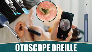 LE MEILLEUR OTOSCOPE CAMÉRA OREILLE  VLIKE [upl. by Addi]