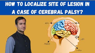 Cerebral palsy in Paediatrics localization of lesion site in different types of cerebral palsy [upl. by Aihseyk]