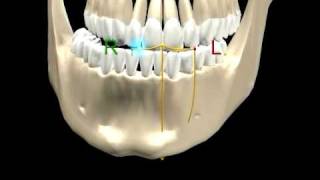 MANDIBULAR MOVEMENTS  1 [upl. by Verina340]