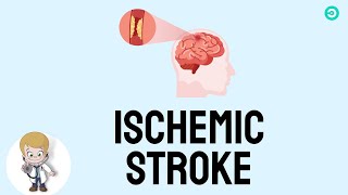 Ischemic Stroke A Comprehensive Guide to Signs types and Treatment [upl. by Preiser]