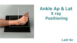 Ankle x ray positioning [upl. by Eniawtna]