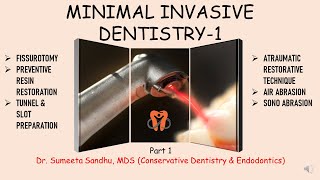 Minimal Invasive Dentistry Atraumatic restorative technique Tunnel amp Slot Preparation Fissurotomy [upl. by Gut378]