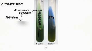 Citrate Test 2 Minutes Microbiology Laboratory Methods Tutorials For NEETPG NEXT USMLE PLAB [upl. by Yerac]